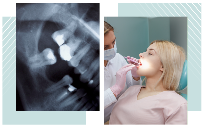 Screenshot 2025-08-28 155626 Teeth exam dentist in Lavon, TX