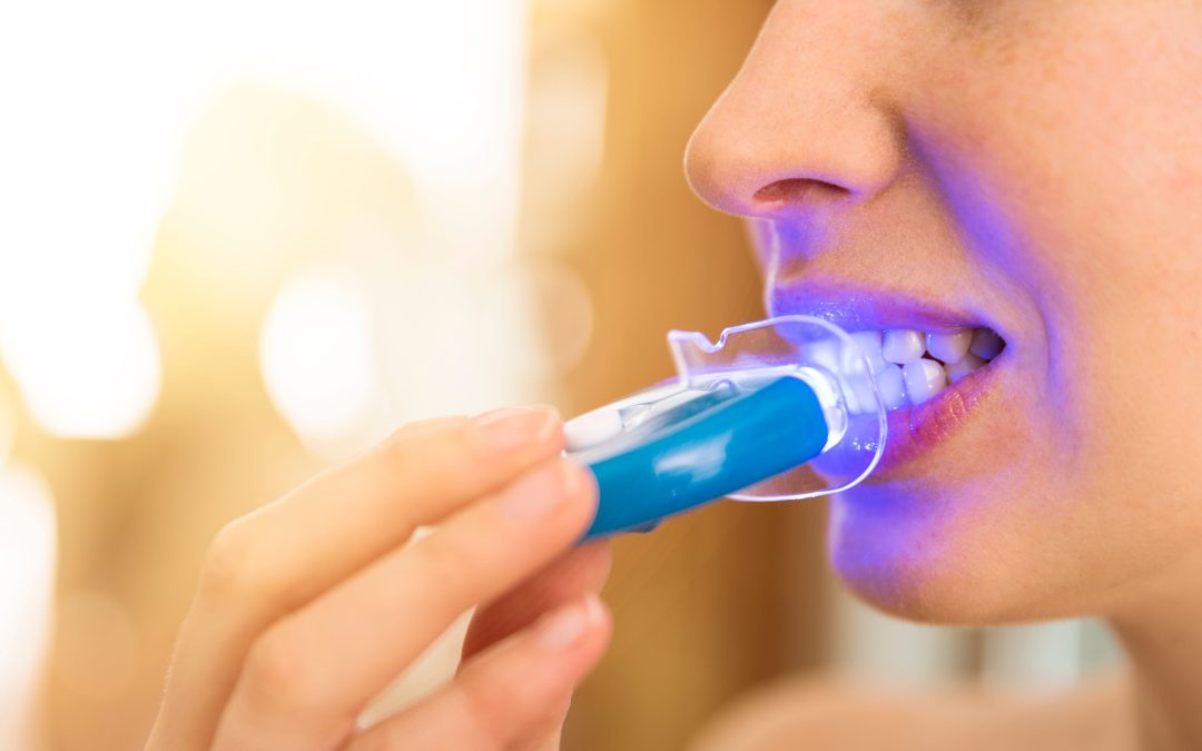 What Teeth Whitening Options Work Best for Adults?