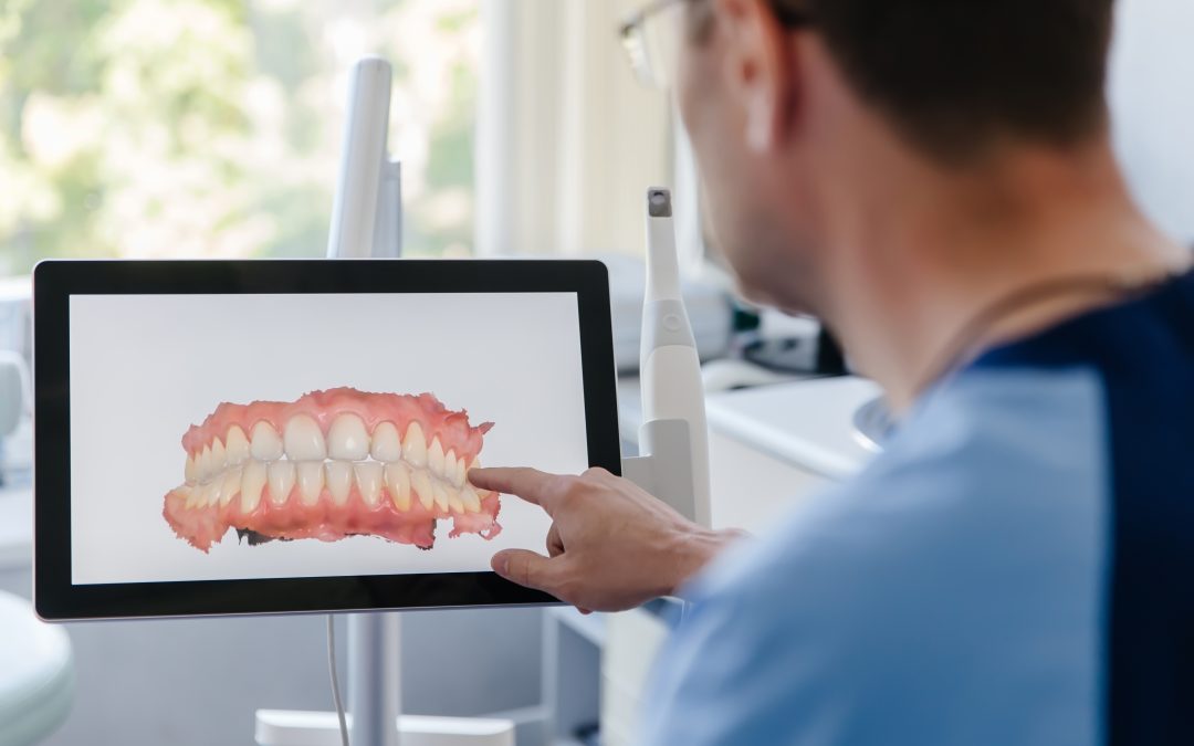 What Happens When You Delay Dental Care for Cavities?